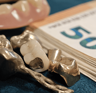 Zahngold Ankauf Portfolio Bild mit fuenfzig euro scheinen - das und mehr kaufen wir bei Johannsson Goldankauf in Rendsburg an